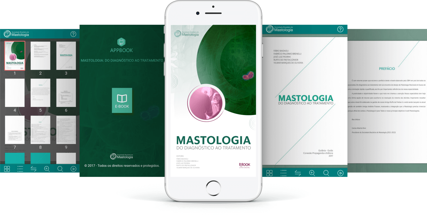 E-book Mastologia Portffólio Conexão